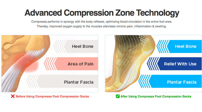 Compressa Compression Socks Review